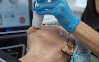 Exploring the Transformative Benefits of CryoSkin Treatments
